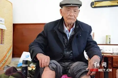 一颗子弹从李华生下巴从左到右穿过,腿上被炮弹炸伤留下伤疤